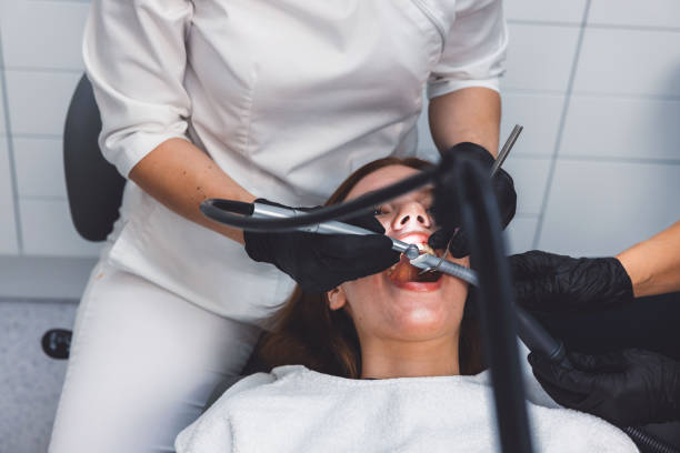 Best Emergency Wisdom Teeth Removal in Gilroy, CA