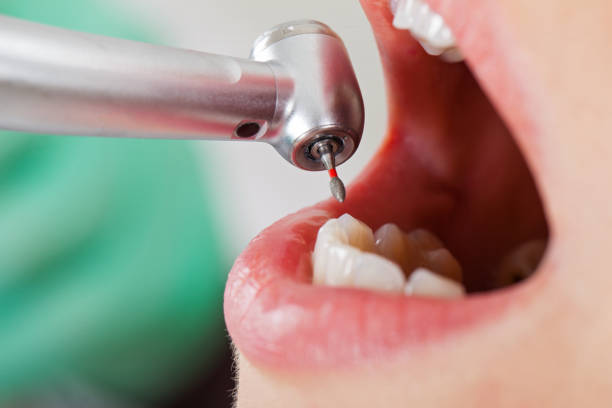 Best After-Hours Emergency Dentist in Gilroy, CA